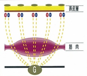 ACボディは筋肉の深部に到達する低周波が特徴